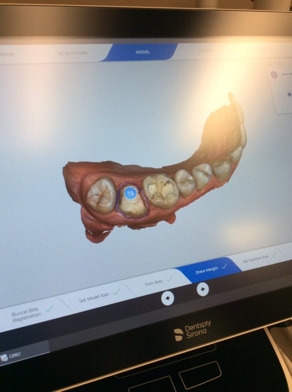 CEREC_Primescan_1