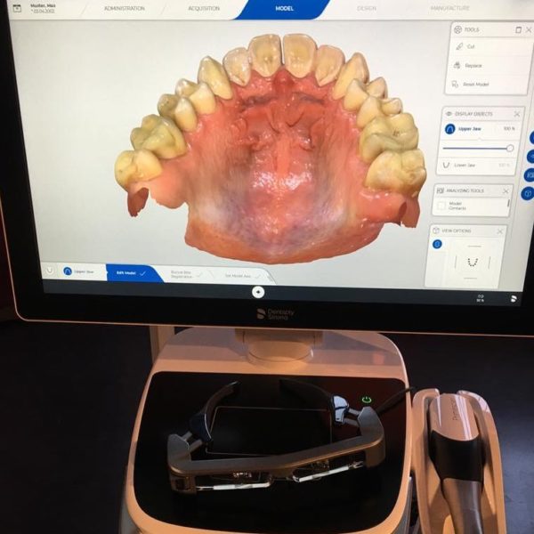 CEREC_Primescan_2