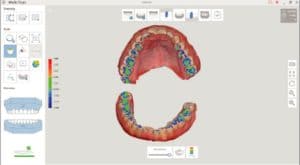 Occlusion Analysis_2x