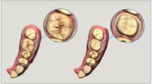 Pre-Operation Scan_2x