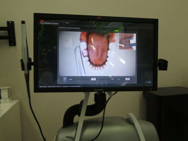 3M-True-Definition-Scanner-For-Sale-13