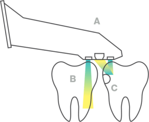 itero-5d-tooth-surface