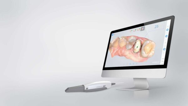 aoralscan-1