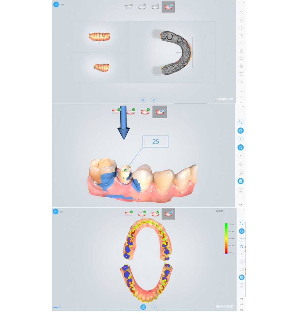Shining3D AORALSCAN Intraoral Dental 3D Scanner