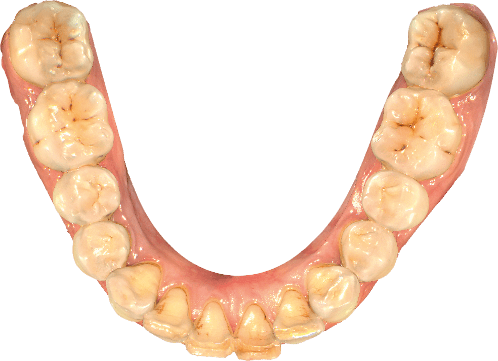 Shining3D AORALSCAN Intraoral Dental 3D Scanner