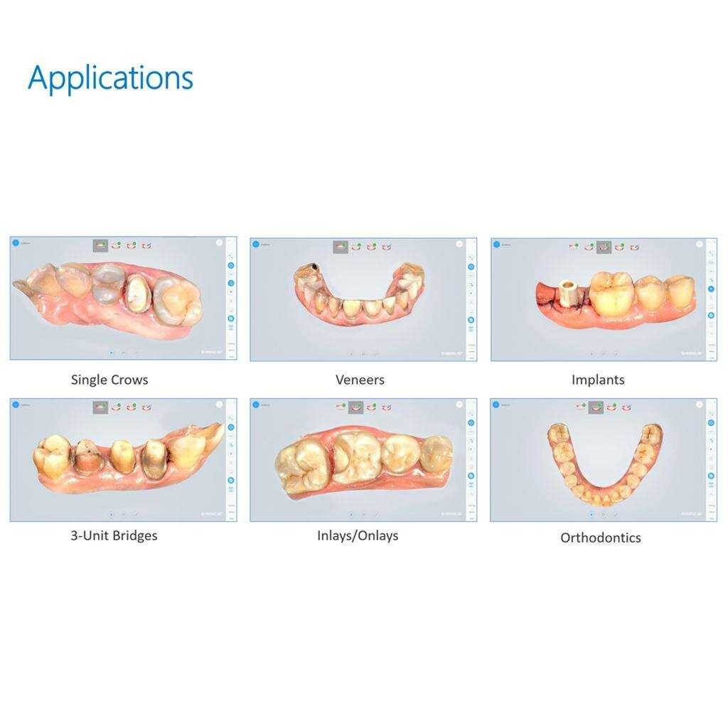 aoralscan applications