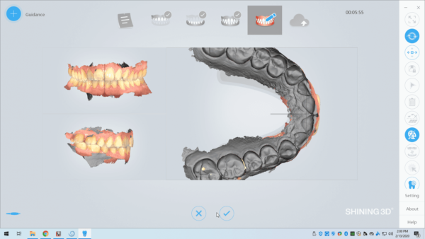 aoralscan-software