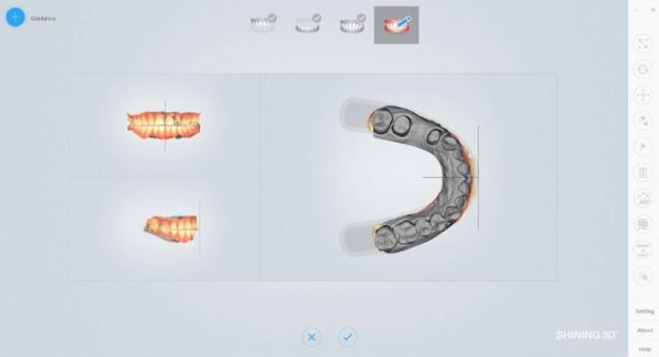 aoralscan2