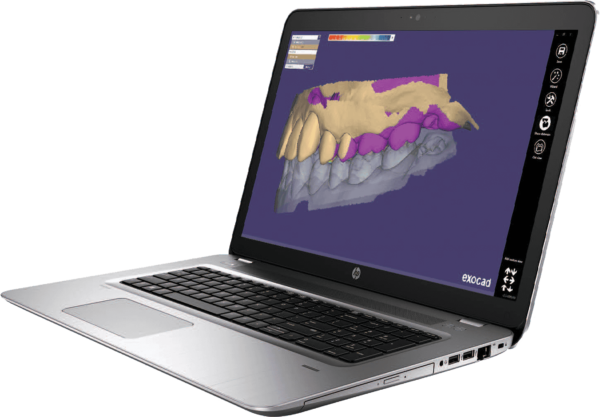 quickscan-ios intraoral-scanner-specs-PC