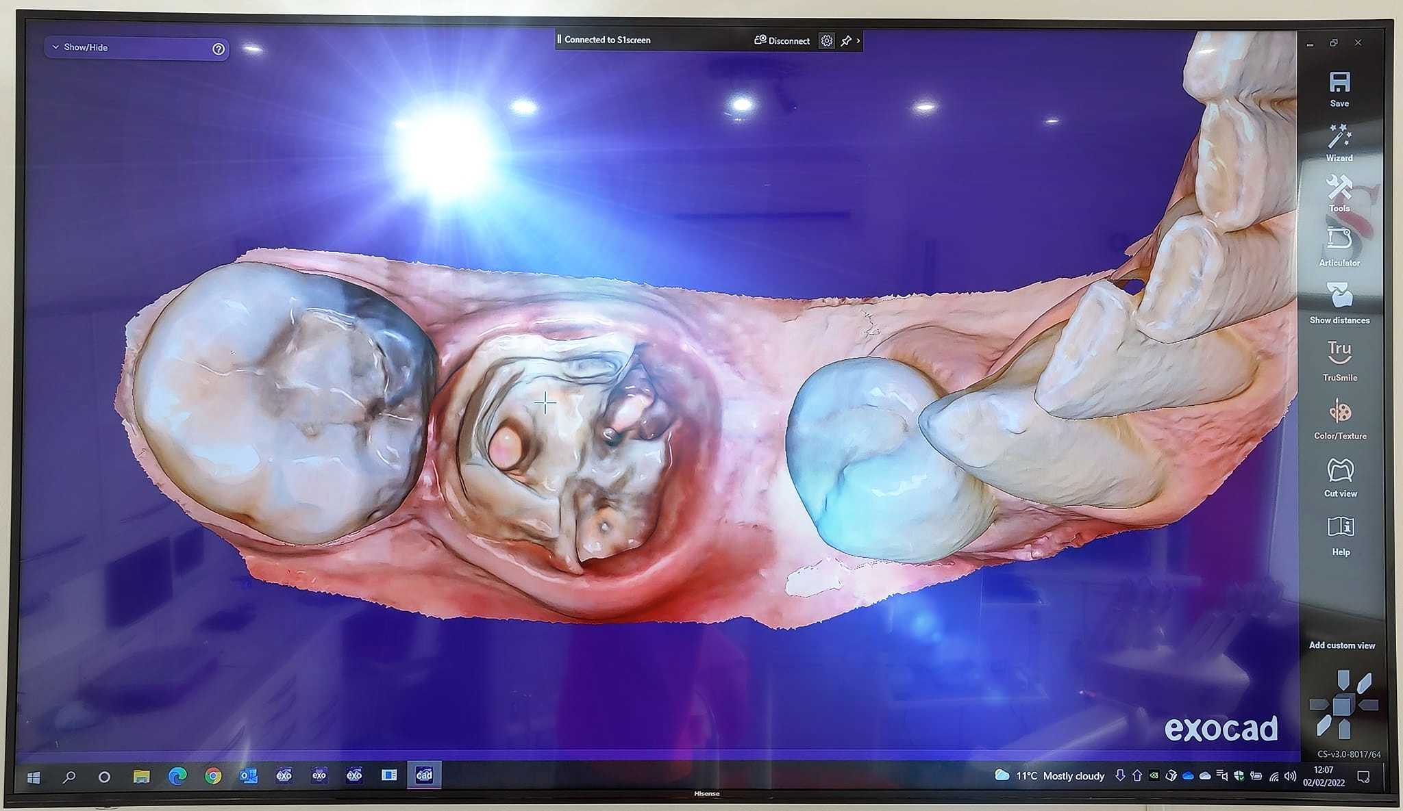Medit i700 Intraoral 3D Dental Scanner ( Wired )