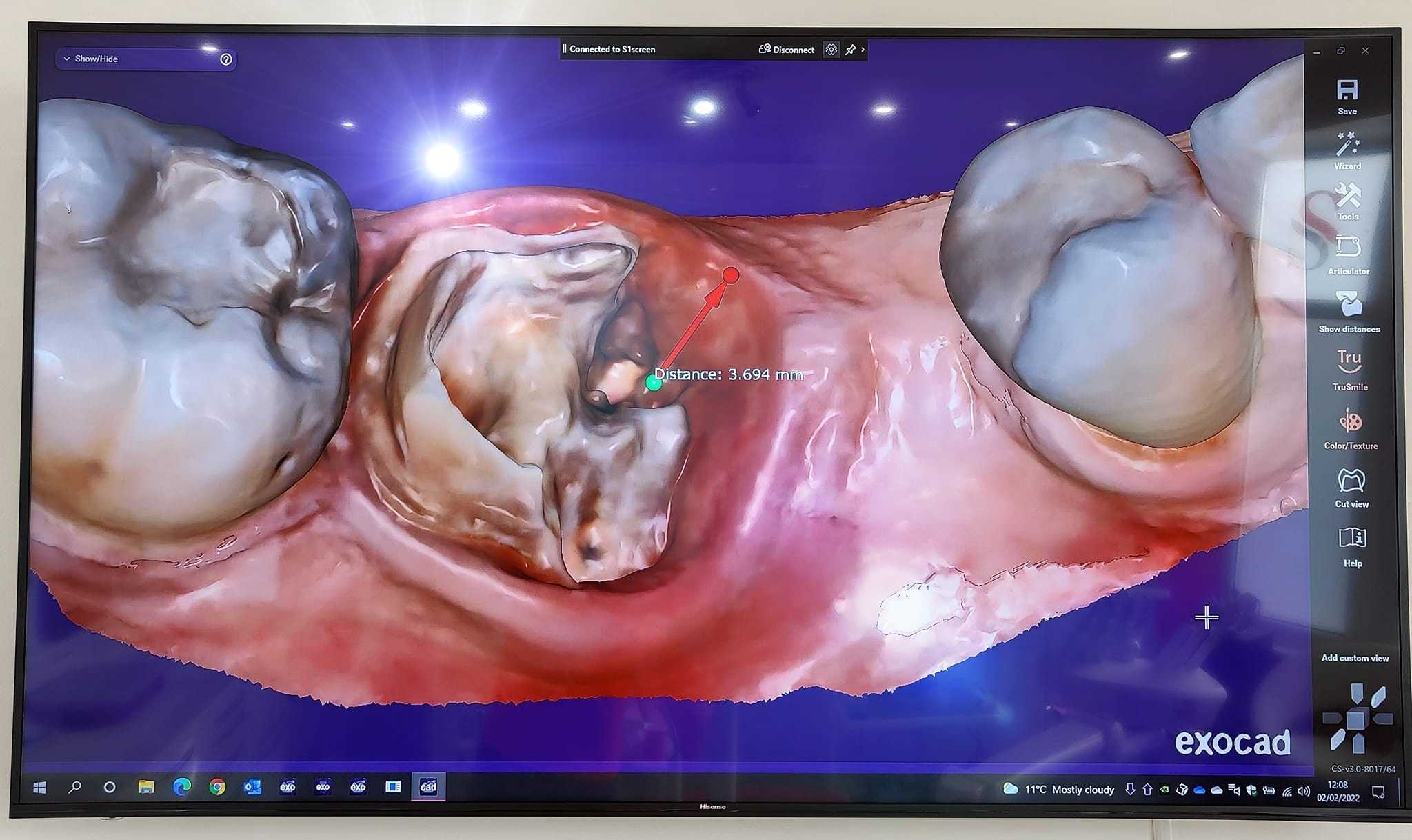 Medit i700 Intraoral 3D Dental Scanner ( Wired )