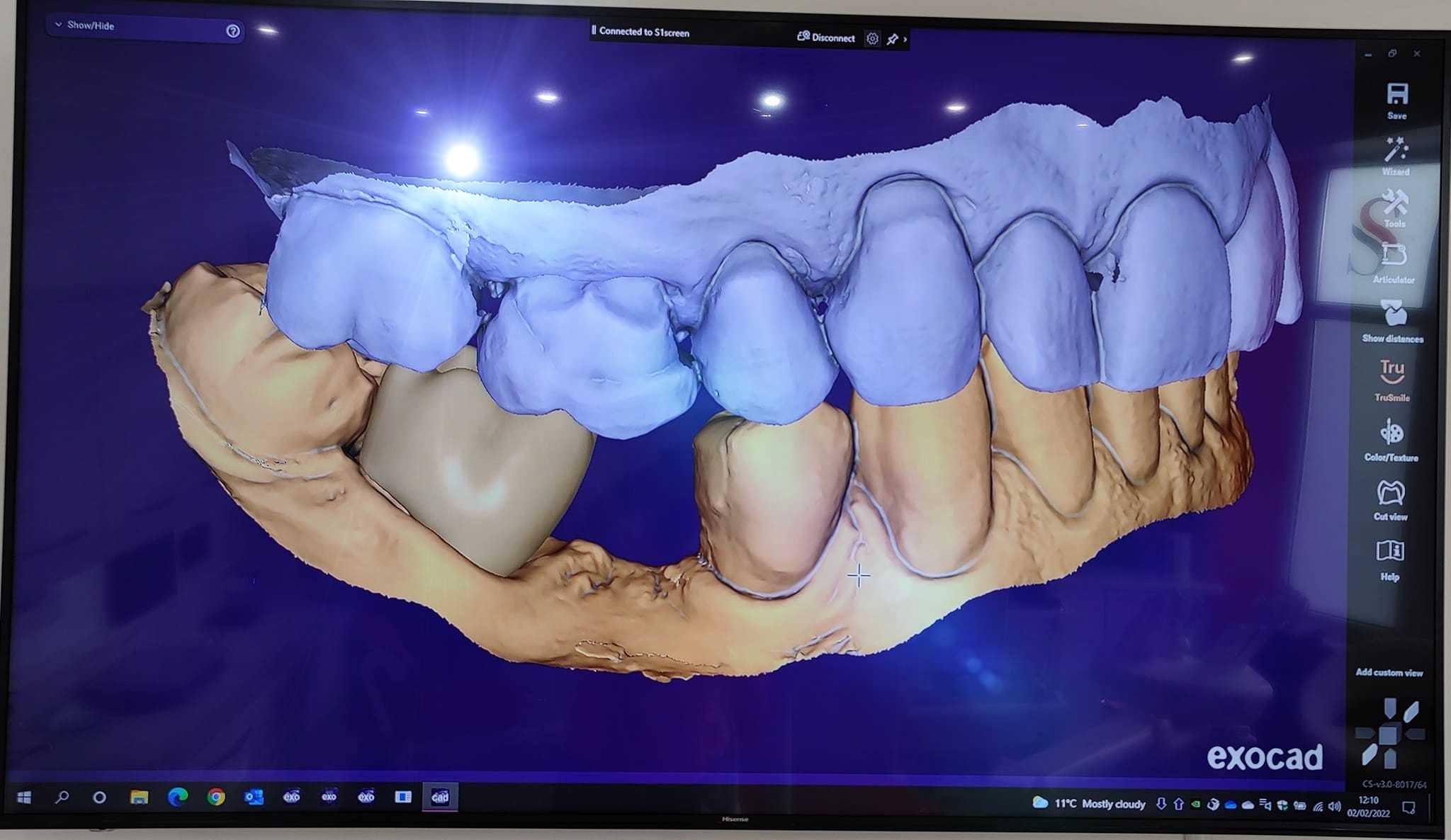 Medit i700 Intraoral 3D Dental Scanner ( Wired )
