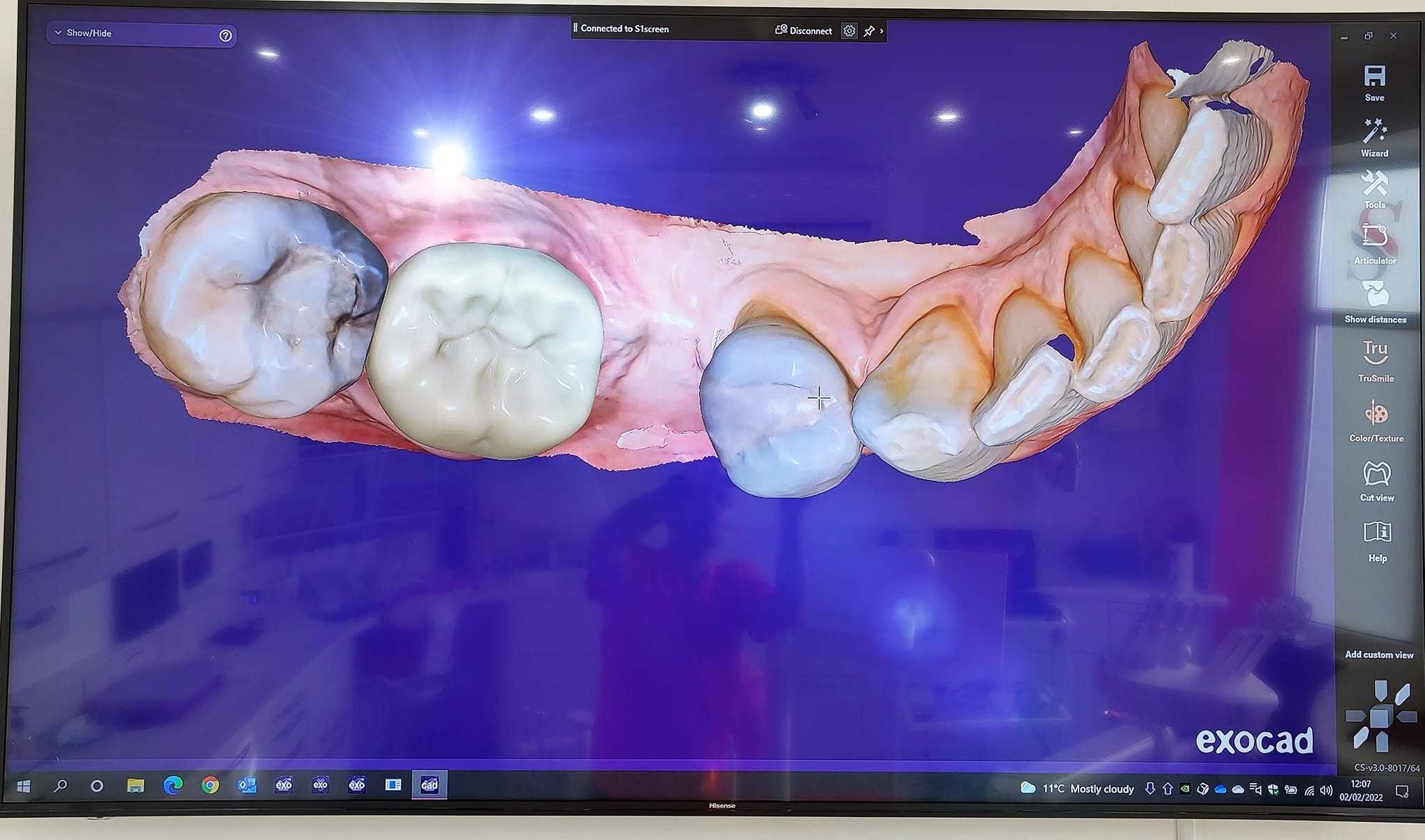 Medit i700 Intraoral 3D Dental Scanner ( Wired )