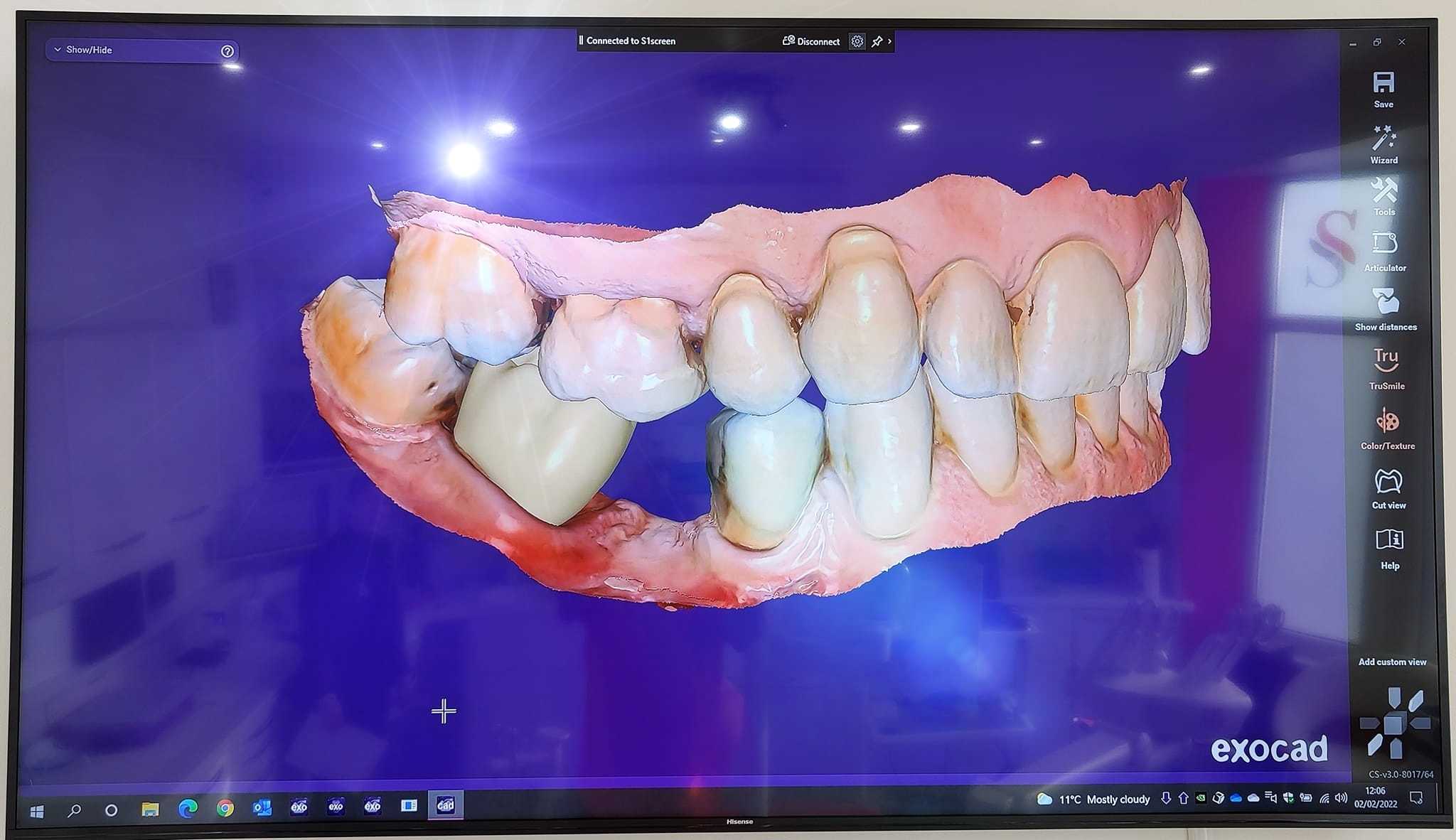Medit i700 Intraoral 3D Dental Scanner ( Wired )