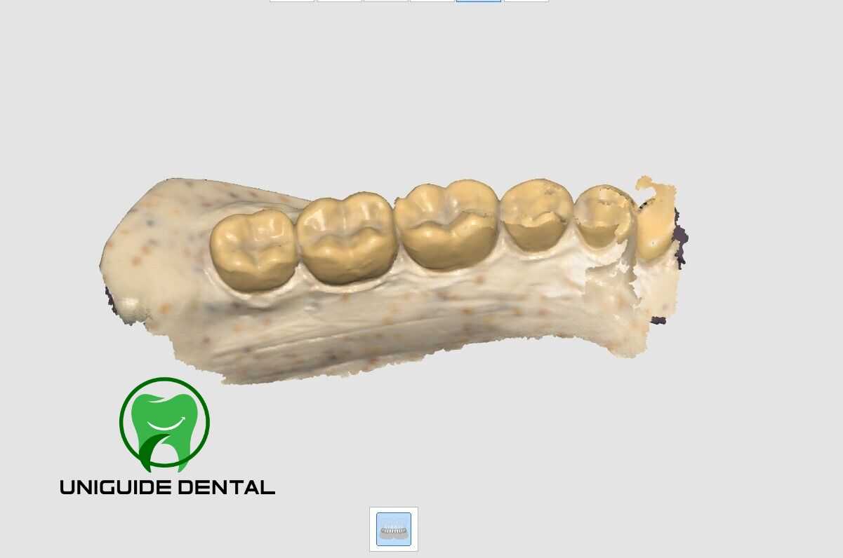 Medit i700 Wireless Intraoral 3D Dental Scanner ( Wireless )