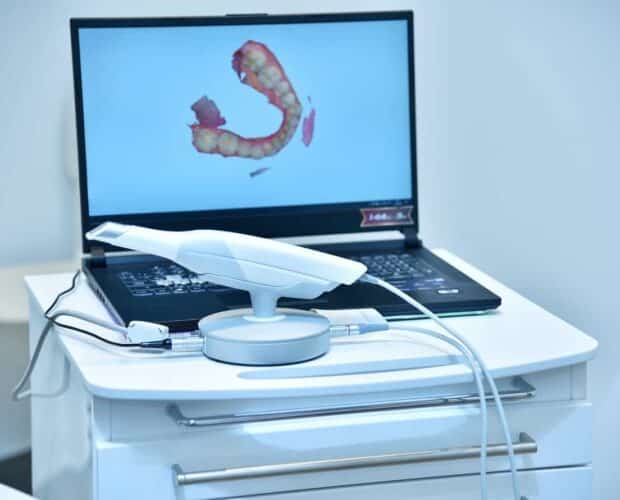 Accuracy of Intraoral Scanners